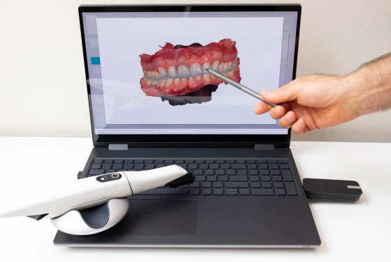 3Shape Intraoral Scanner
