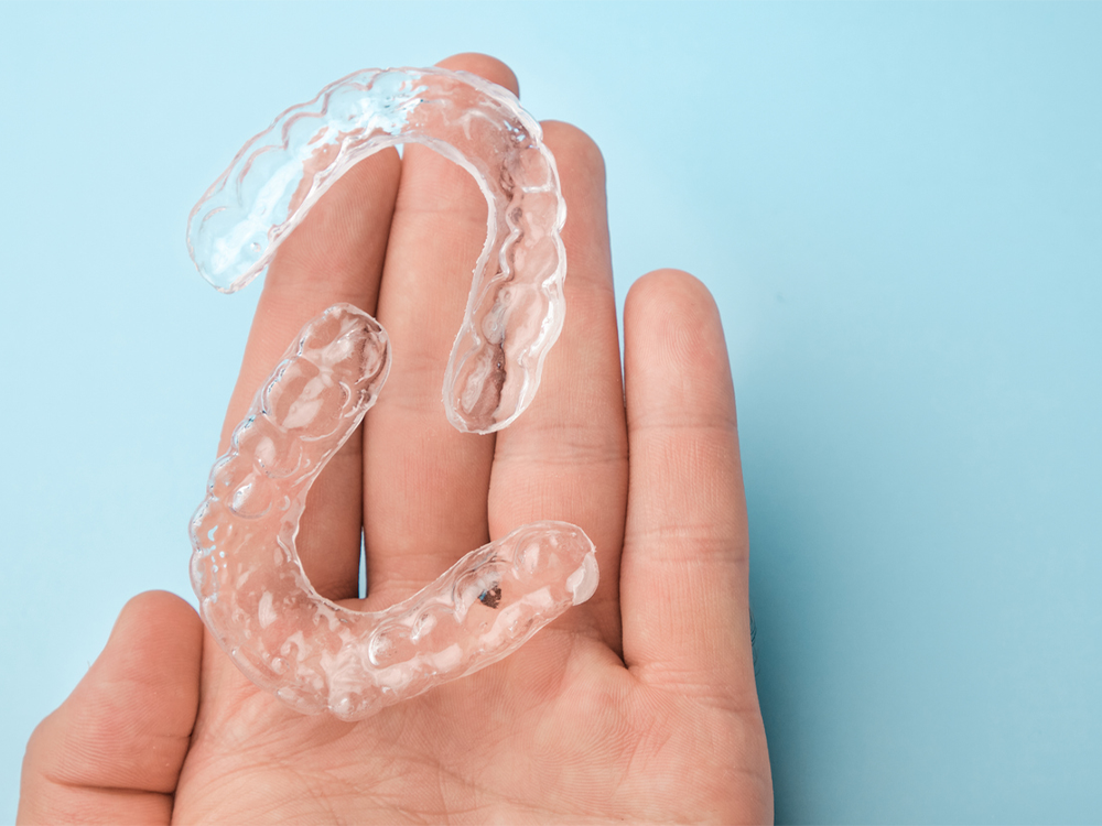 Dental Retainers